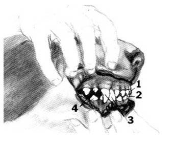 dentition