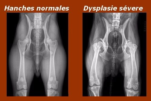 Luxation Congenitale De La Hanche Symptomes Et Signes