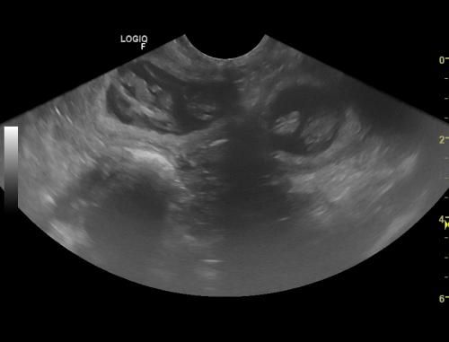 au Royaume D'ultra - comfirmation gestation