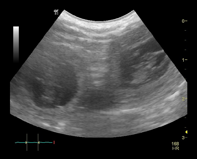 au Royaume D'ultra - bientot des bébés d'edina